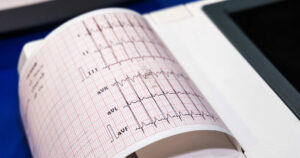 A thermal printer mechanism used in a patient monitoring device for healthcare.